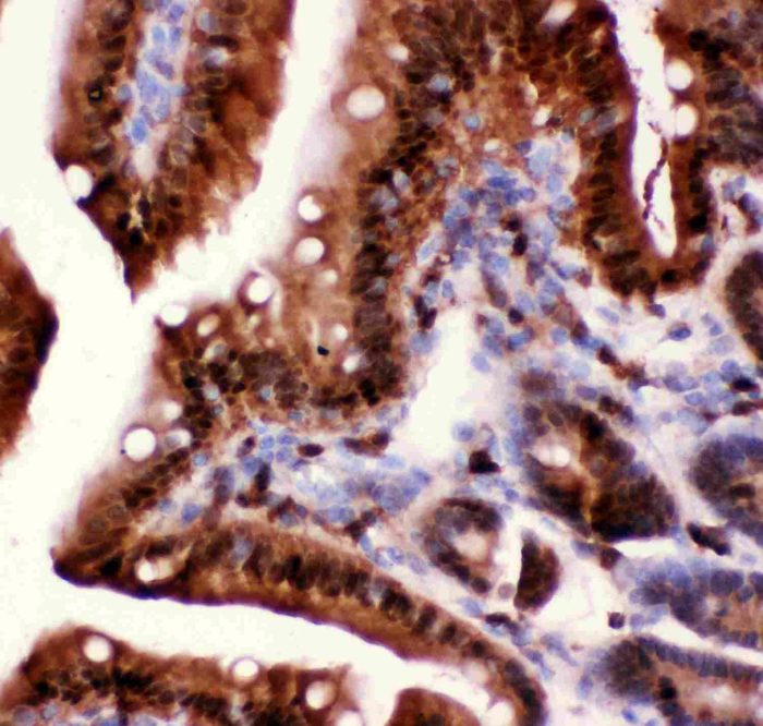 Caspase 5